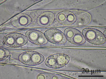 Octospora humosa, ascus with ascospores