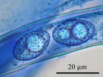 Octospora humosa, ascus with ascospores