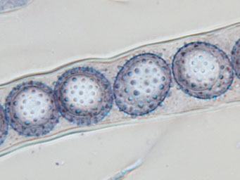 Octospora americana