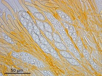 Octospora axillaris, ascus with ascospores