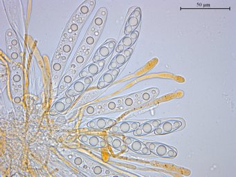 Octospora axillaris var. tetraspora, asci with ascospores