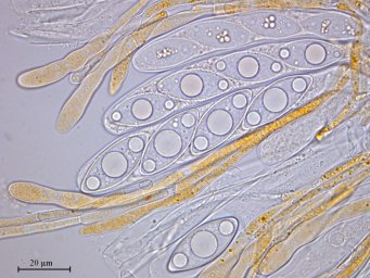 Octospora axillaris var. tetraspora, asci with ascospores