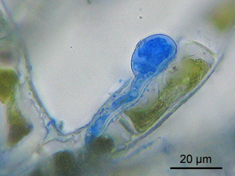 Octospora bridei, appressorium on protonema