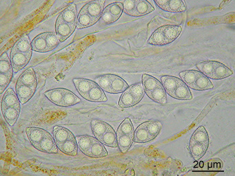 Octospora bridei, asci with ascospores