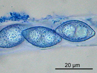 Octospora bridei, ascus with ascospores