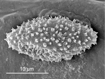 Octospora bridei, SEM-image of ascospore