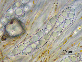Octospora coccinea, ascus with ascospores
