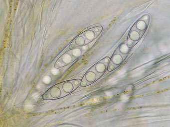 Octospora coccinea var. tetraspora