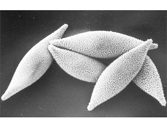 Octospora echinospora