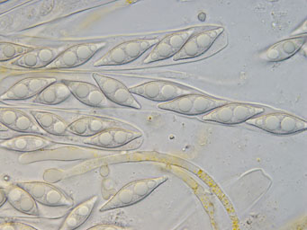 Octospora echinospora