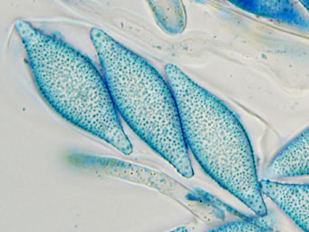 Octospora echinospora