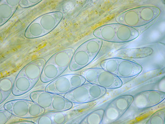 Octospora entosthodontophila>