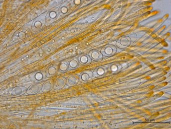 Octospora excipulata, Asci with Spores