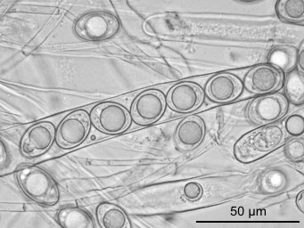 Octospora excipulata, ascospores