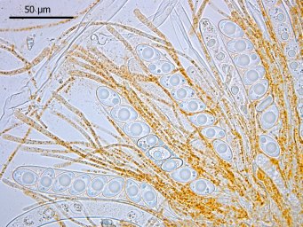 Octospora gyalectoides, asci with ascospores