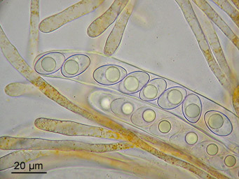 Octospora gyalectoides, ascus with ascospores
