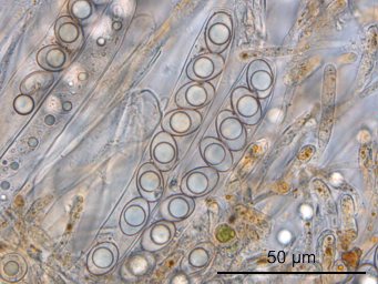 Octospora hetieri, ascus with ascospores