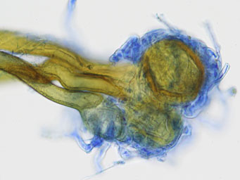 Octospora hygrohypnophila