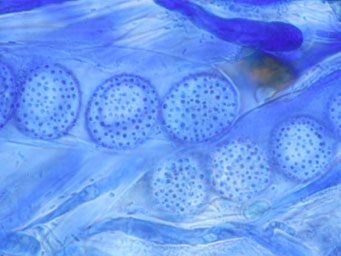 Octospora hygrohypnophila
