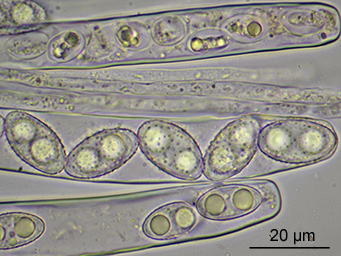 Octospora ithacaensis