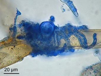 Octospora itzerottii, appressorium and hyphae around a rhizoid
