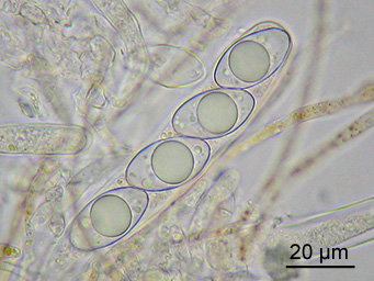 Octospora itzerottii, asci with ascospores