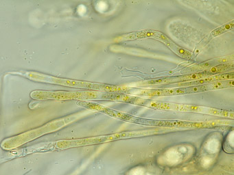 Octospora leucoloma