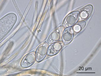 Octospora leucoloma, ascus with ascospores