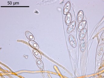 Octospora leucoloma var. tetraspora, asci with ascospores