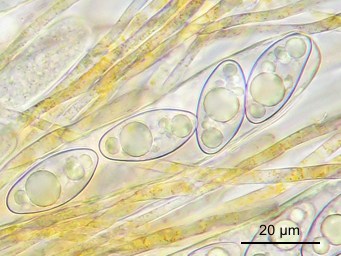 Octospora leucoloma var. tetraspora, ascus with ascospores