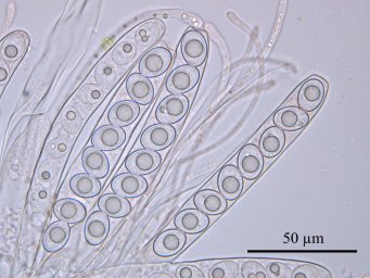 Octospora lilacina, asci with ascospores