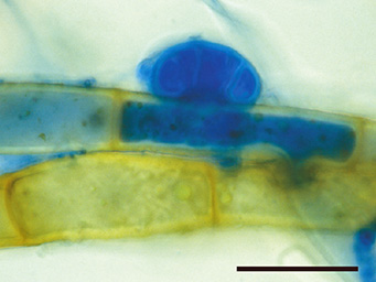Octospora mnii, appressorium