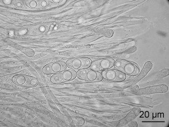 Octospora musci-muralis, Ascus with spores
