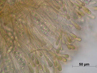 Octospora musci-muralis var. neglecta