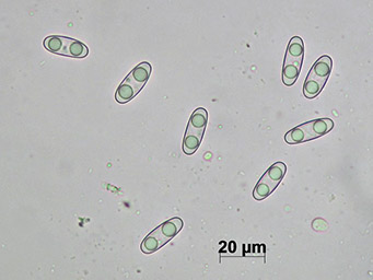 Octospora musci-muralis var. neglecta