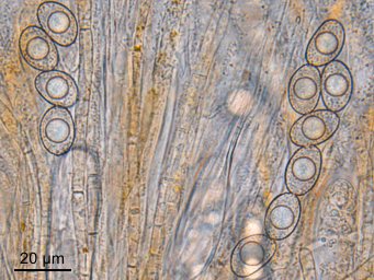 Octospora orthotricha, ascospores