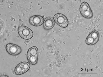 Octospora orthotricha, free ascospores