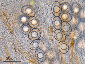 Octospora orthotricha, ascospores