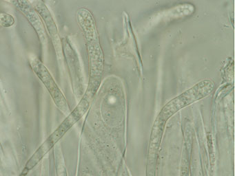 Octospora oscarii