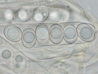 Octospora oscarii