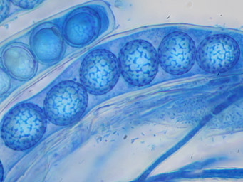 Octospora pannosa, spores