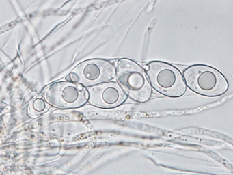 Octosporella perforata