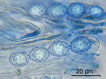 Octospora phagospora, asci with ascospores