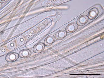 Octospora pseudoampezzana, ascus with ascospores