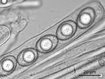 Octospora pseudoampezzana, ascus with ascospores