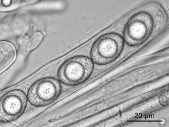 Octospora pseudoampezzana, ascus with ascospores