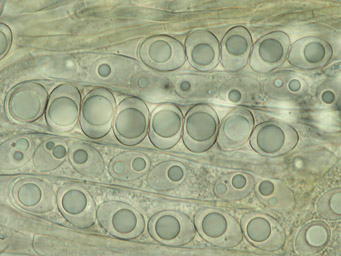Octospora rustica, asci with ascospores