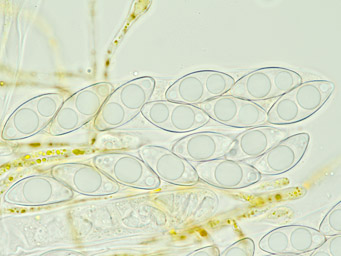 Octospora sulcatispora