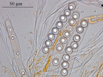 Octospora wrightii, asci with ascospores