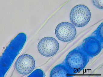 Octospora wrightii, asci with ascospores